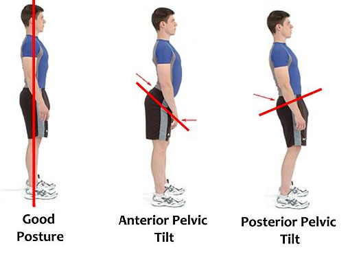 Neutral Pelvis